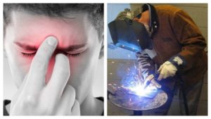 Наловился зайчиков от сварки что делать