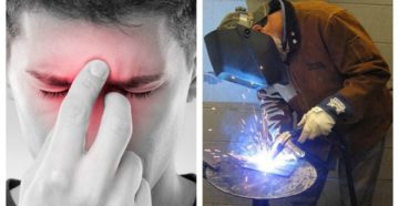 Наловился зайчиков от сварки что делать Наловился зайчиков от сварки что делать